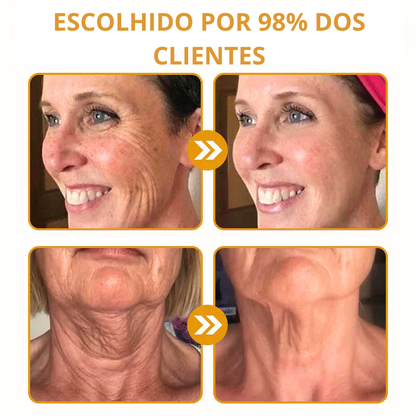 Creme Remoção de Rugas com Botox e Veneno de Abelha
