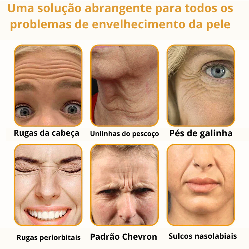 Creme Remoção de Rugas com Botox e Veneno de Abelha