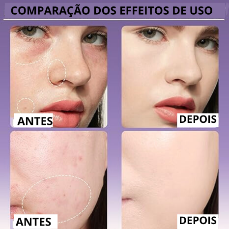 Corretivo cremoso suave e matte