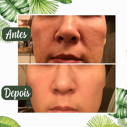 Máscara Natural de chá verde para Pele Limpia e Hidratada